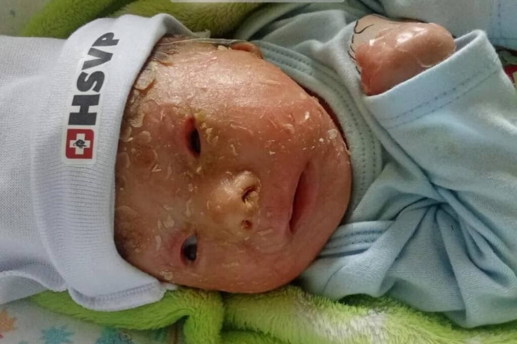 Bebê de Constantina enfrenta doença rara e luta pela vida